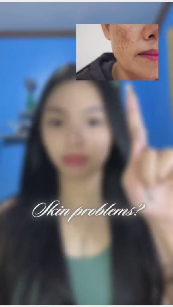 Niacinamide Soap Bar